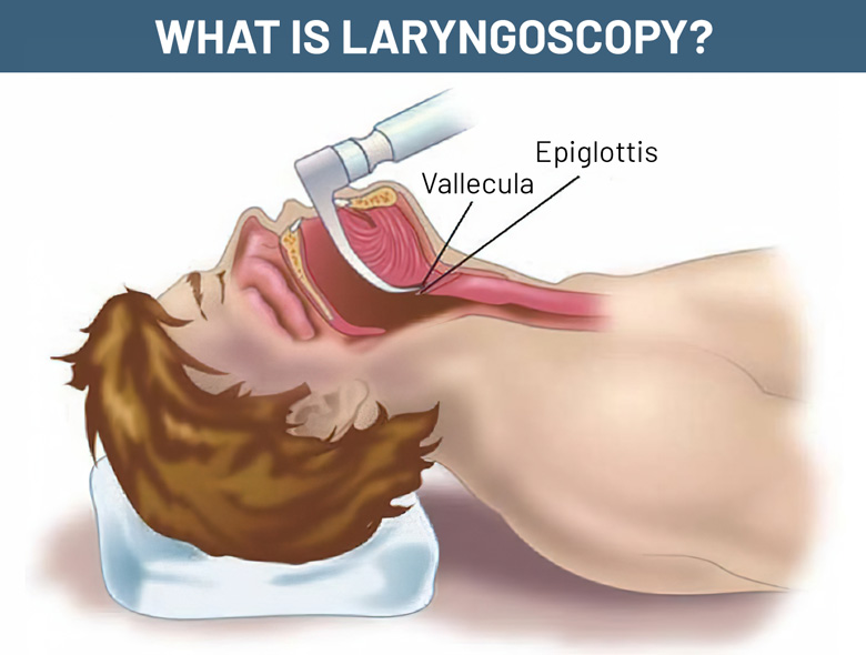 What Is A Laryngoscopy?