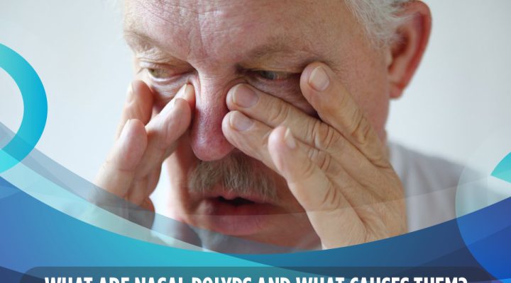 What Are Nasal Polyps and What Causes Them?