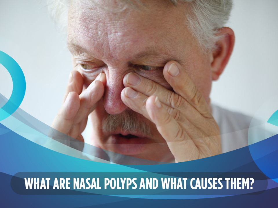 What Are Nasal Polyps and What Causes Them?