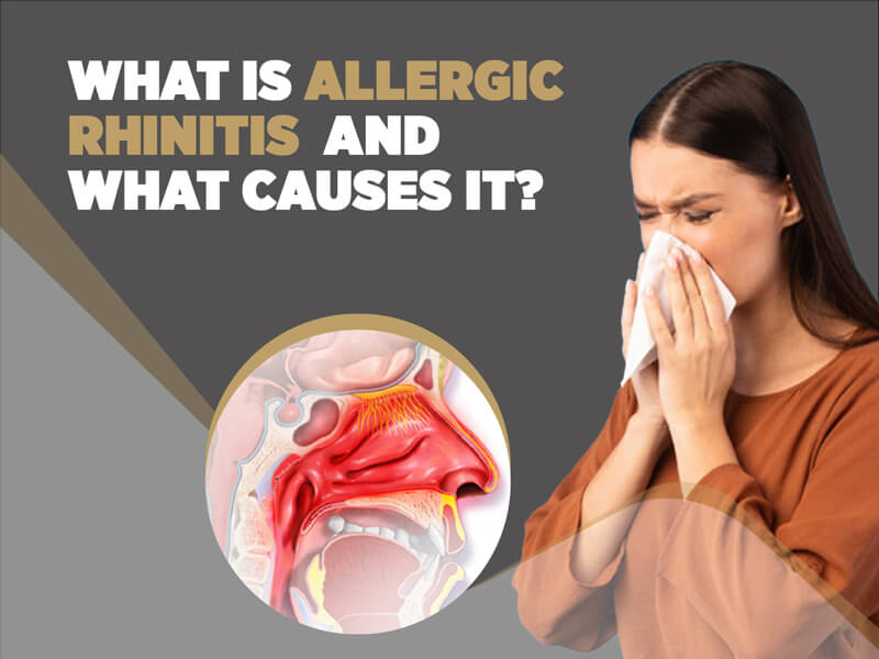 Treating Allergic Rhinitis From Seasonal Allergies