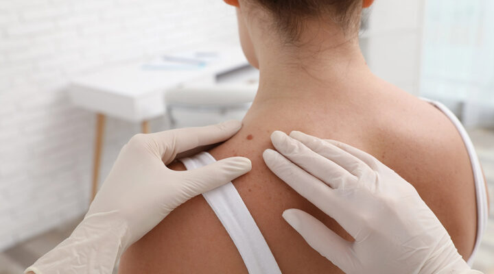 woman at her dermatology appointment